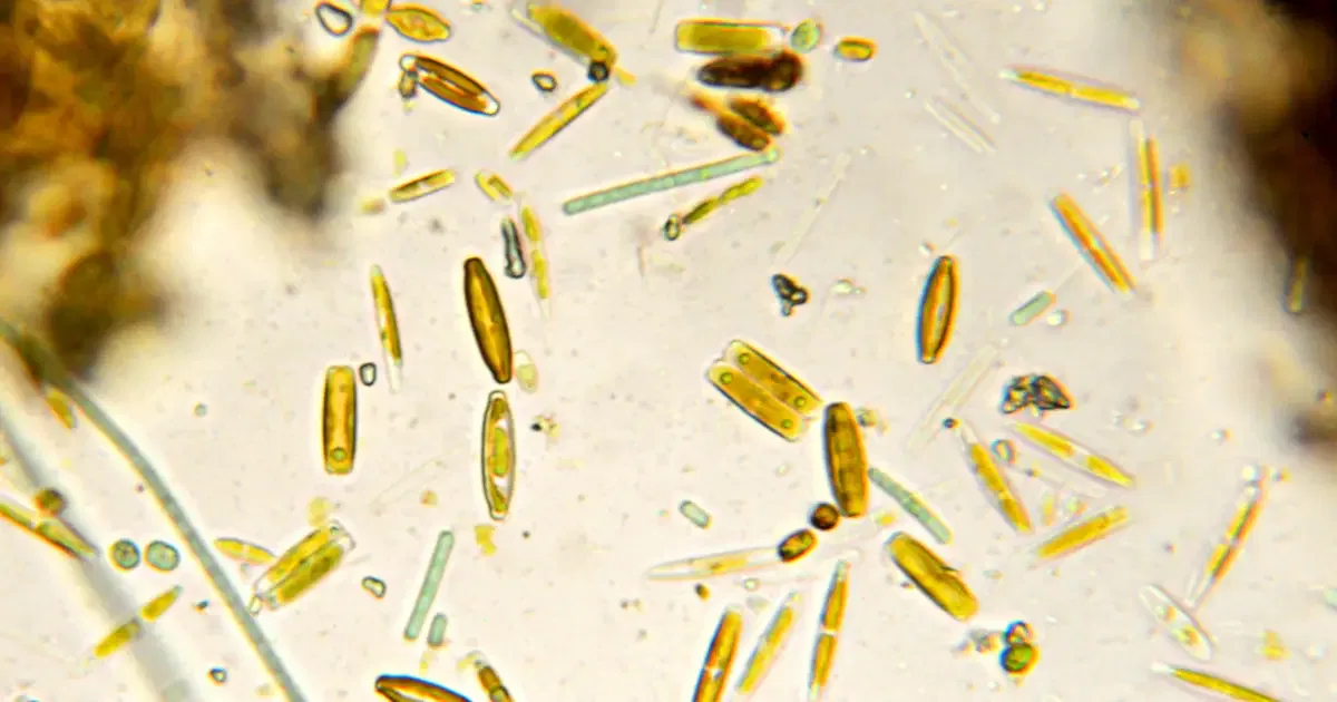 ¿Qué es la tierra de diatomeas y para qué sirve?